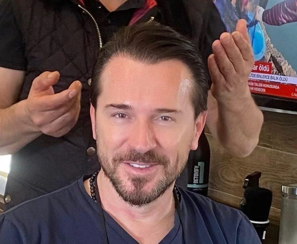 Uğur Arslan estetik yüzünden tanınmaz hale geldi! İşte botoks canavarının son hali...